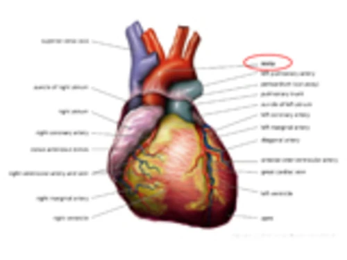 Hội chứng chuyển hóa có thể dẫn đến vấn đề tim nghiêm trọng