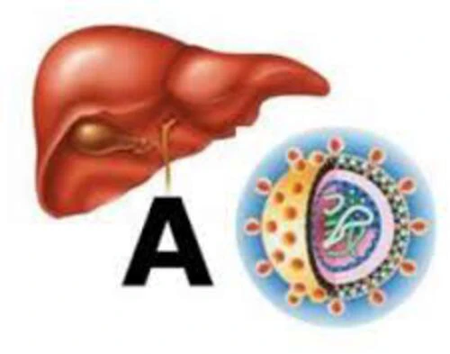 Dấu hiệu có thể bạn mắc bệnh viêm gan A